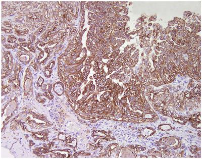 From Conventional to Precision Therapy in Canine Mammary Cancer: A Comprehensive Review